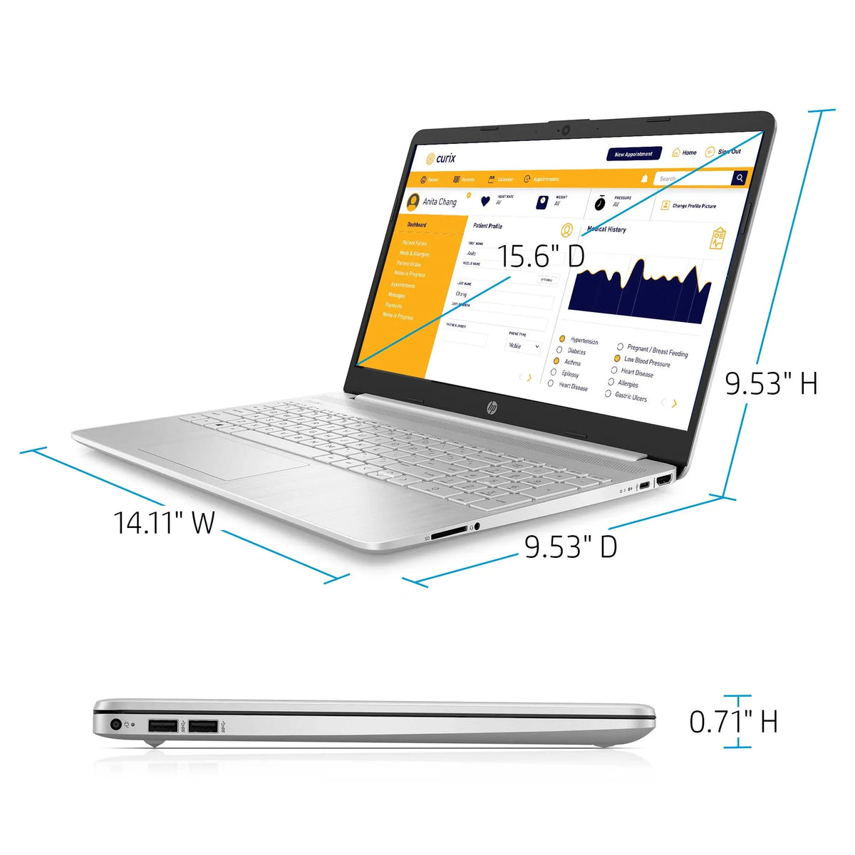 15.6" i3 8GB/512GB Notebook
